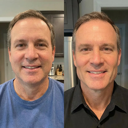 Masque Sculptant Mâchoire Homme — Elyva Paris™