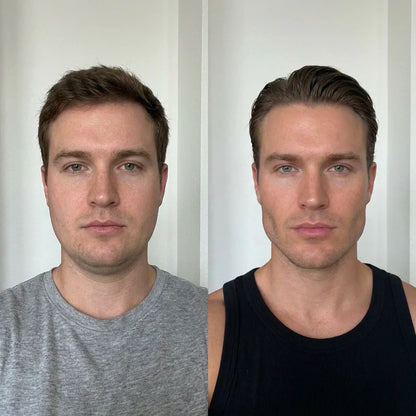 Masque Sculptant Mâchoire Homme — Elyva Paris™